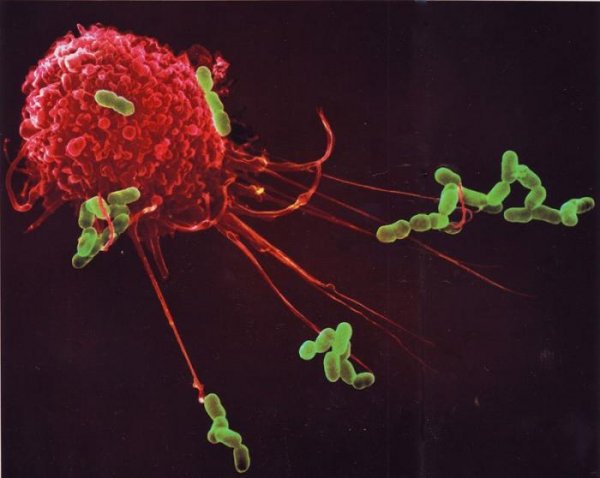 Наша невероятная иммунная система (17 фото)