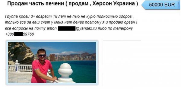 Отчаявшиеся люди продают внутренние органы (5 фото)