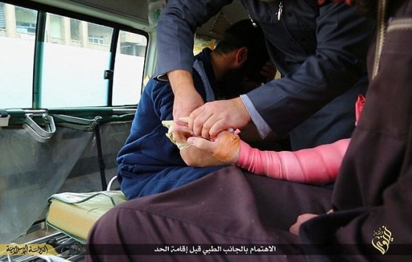 Боевики ИГИЛа вновь отрубили руку вору (8 фото) Боевики ИГИЛа вновь отрубили руку вору (8 фото)