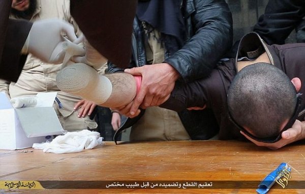 Боевики ИГИЛа вновь отрубили руку вору (8 фото) Боевики ИГИЛа вновь отрубили руку вору (8 фото)